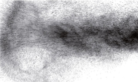 Ultrafine Particles